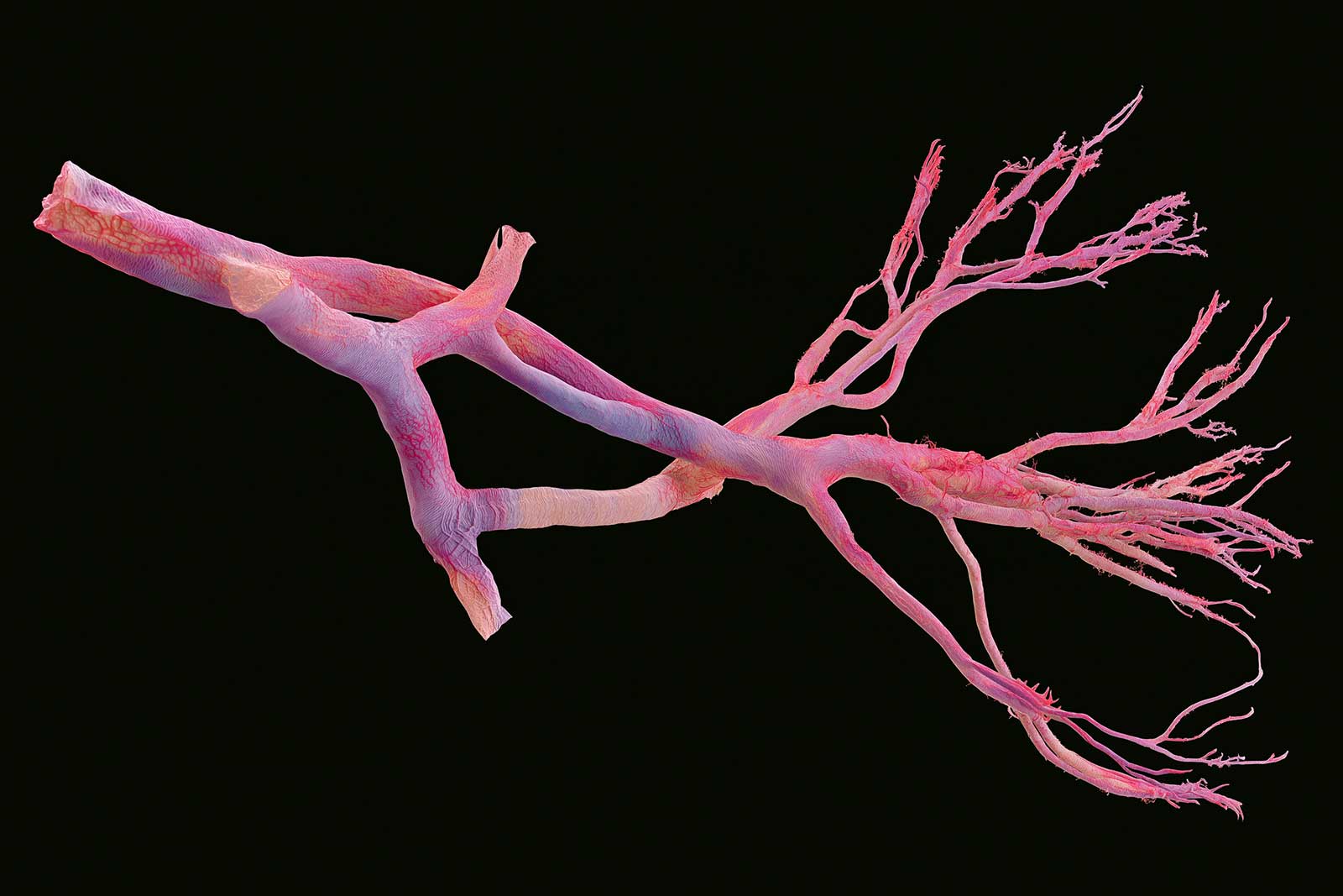 Abstract visualization of coronary artery blood flow